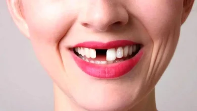 تعبیر خواب افتادن دندان